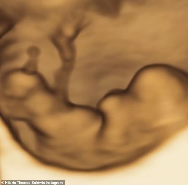 Great news: The mother of four later shared a picture of her 4D sonogram, writing: 